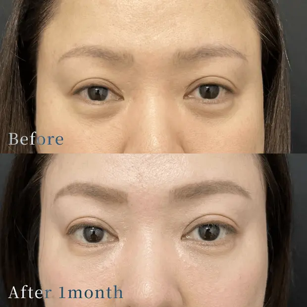 X CLINIC 症例写真 Before/After