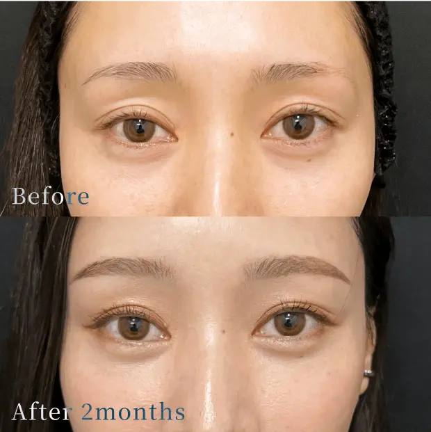 X CLINIC 症例写真 Before/After
