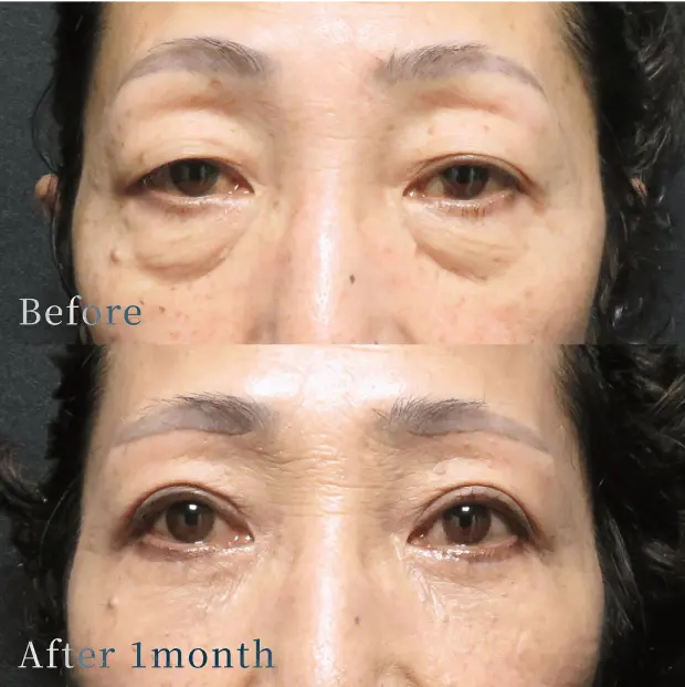 X CLINIC 症例写真 Before/After