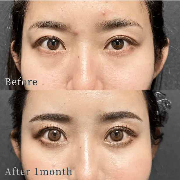 X CLINIC 症例写真 Before/After