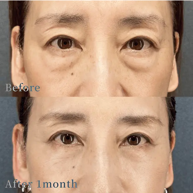 X CLINIC 症例写真 Before/After