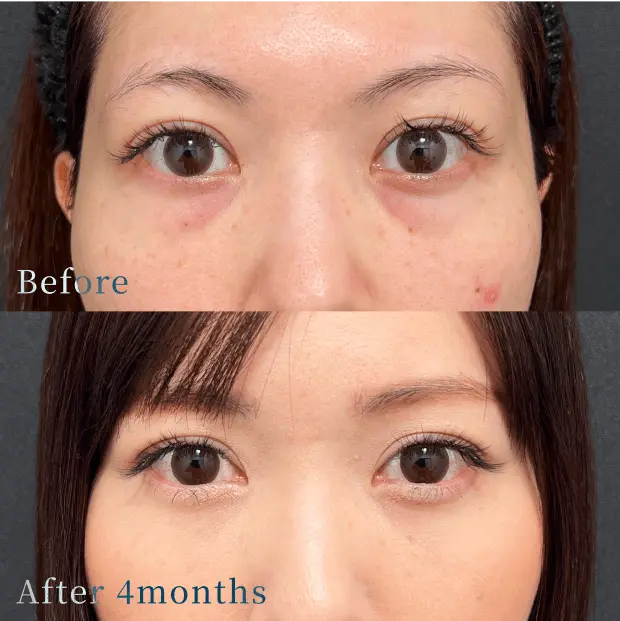 X CLINIC 症例写真 Before/After